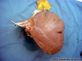 <p>what part of the coronary ligament of the liver is being highlighted?</p>