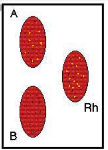 <p>What is the blood type indicated by the results in the right tray?</p>