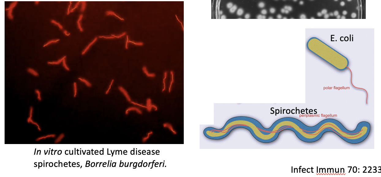 <p>Gram negative (have LPS) </p><p>Highly motile cells via perirlasmic flagellae (not exposed) </p>