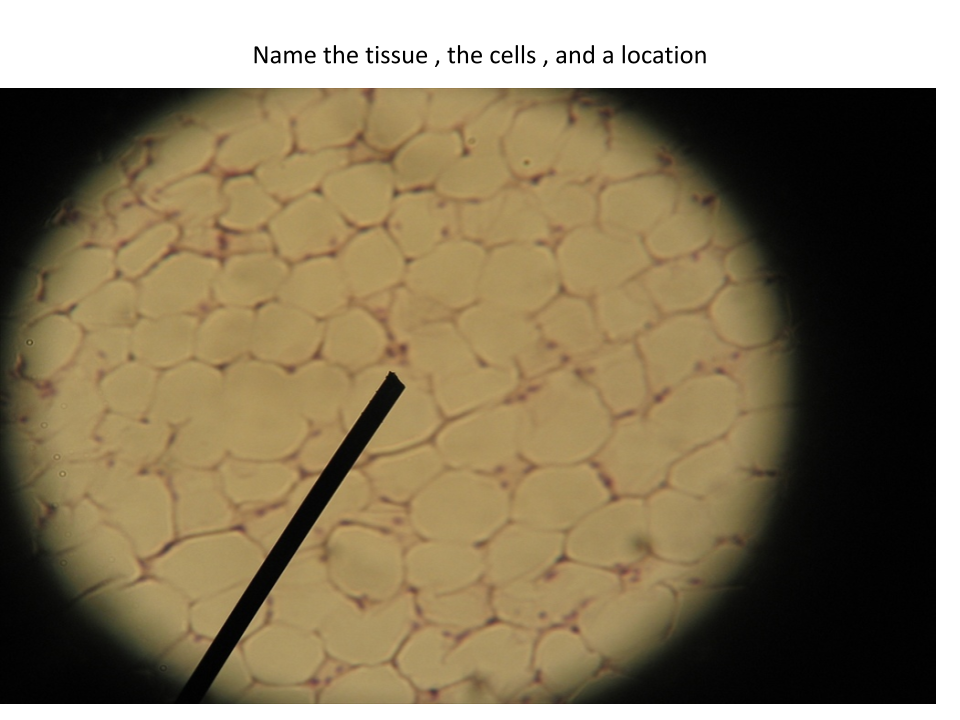 <p>Name of tissue?</p>