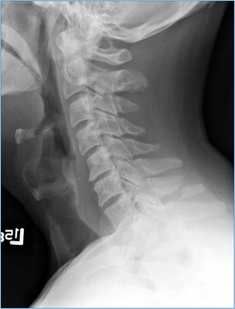 <p>What is the diagnosis?</p>