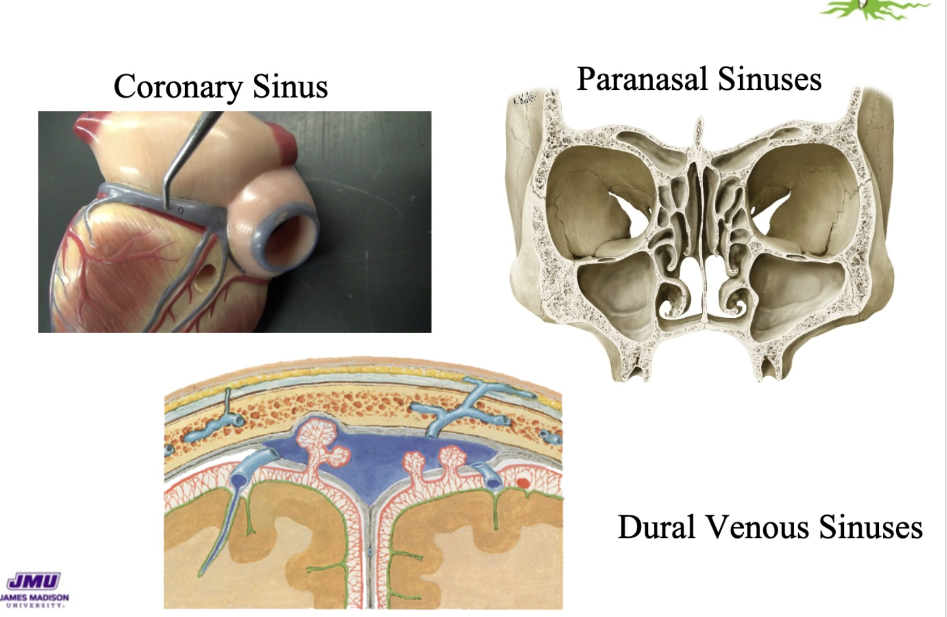 <ul><li><p><span style="color: rgb(0, 0, 0);"><mark data-color="#fdff09" style="background-color: rgb(253, 255, 9); color: inherit;">a </mark><strong><mark data-color="#fdff09" style="background-color: rgb(253, 255, 9); color: inherit;">sinus </mark></strong><mark data-color="#fdff09" style="background-color: rgb(253, 255, 9); color: inherit;">is a </mark><strong><mark data-color="#fdff09" style="background-color: rgb(253, 255, 9); color: inherit;">hollow space</mark></strong></span></p></li><li><p>We’ve learnt abut the<strong> coronary sinus-</strong><span style="color: red;"><strong>collects deoxygenated blood and carries it to right atrium</strong></span></p></li><li><p><strong>paranasal sinus- </strong><span style="color: red;"><strong>air filled hollow space that fills when congested </strong></span></p></li><li><p><strong>dural sinus -</strong><span style="color: red;"><strong> blood filled space built in <u>dura mater folds</u></strong></span></p></li></ul><p></p>