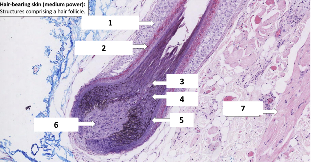 <p>Name the structure indicated by 1.</p>