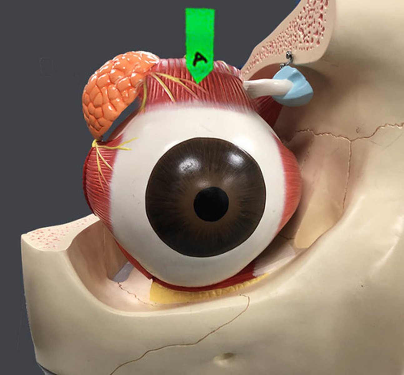 <p>Identify this muscle.</p>