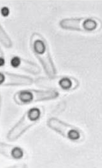 <p>identify;</p><ul><li><p>spore location</p></li><li><p>bacteria</p></li></ul><p></p>