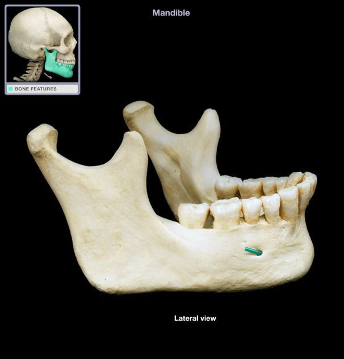 <p>(what bone and bone marking)</p>