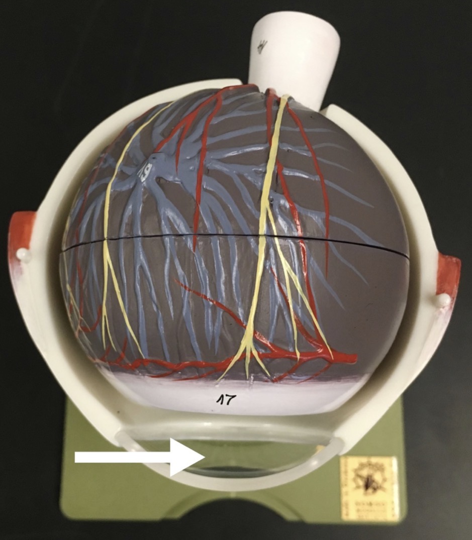 <p><span>name the FLUID that would be found at the end of the arrow's point</span></p>