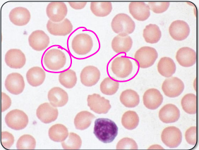 <p>normocytic, normochromic</p>