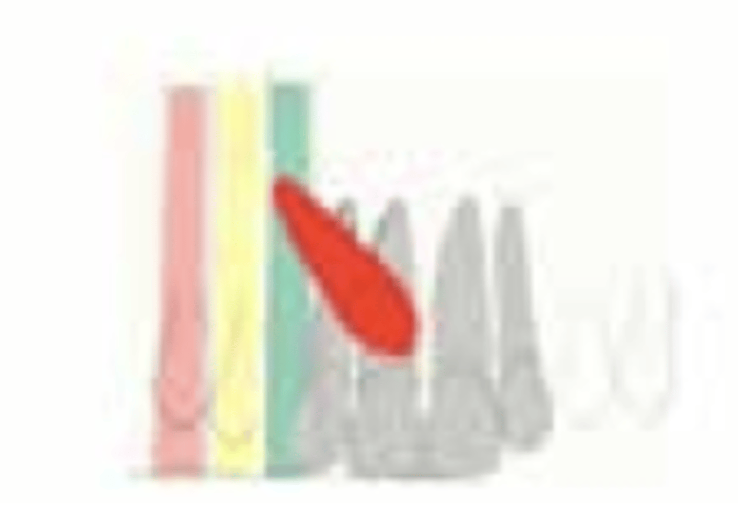 <p>What is the prognosis?</p><p>- Position of apex: Above canine position</p>