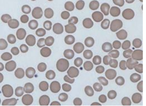 <p>What type of red blood cell?</p>