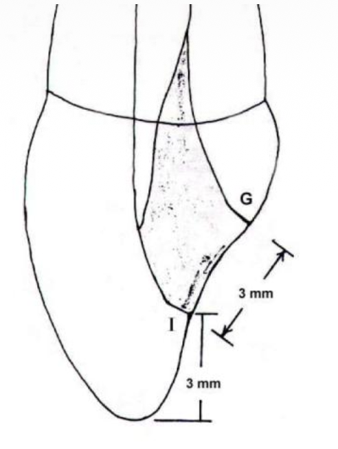 <p>Size of maxillary canine access</p>