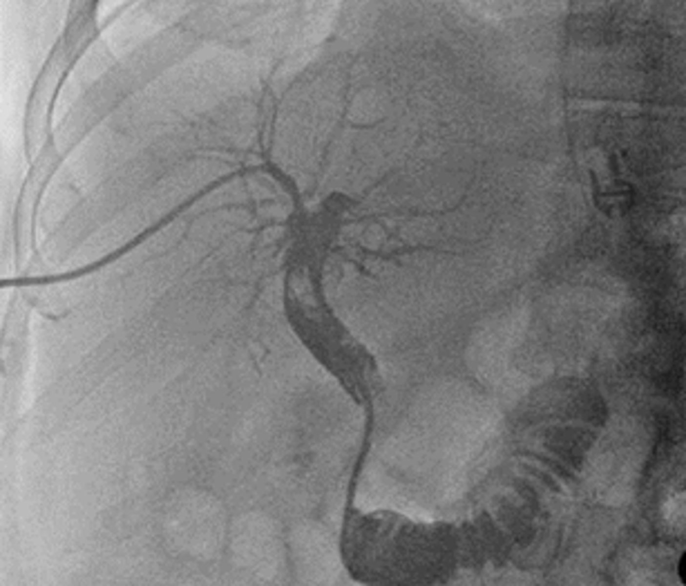 <p>Cholangiography</p>