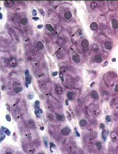 <p>what is the liver parenchyma composed of?</p>