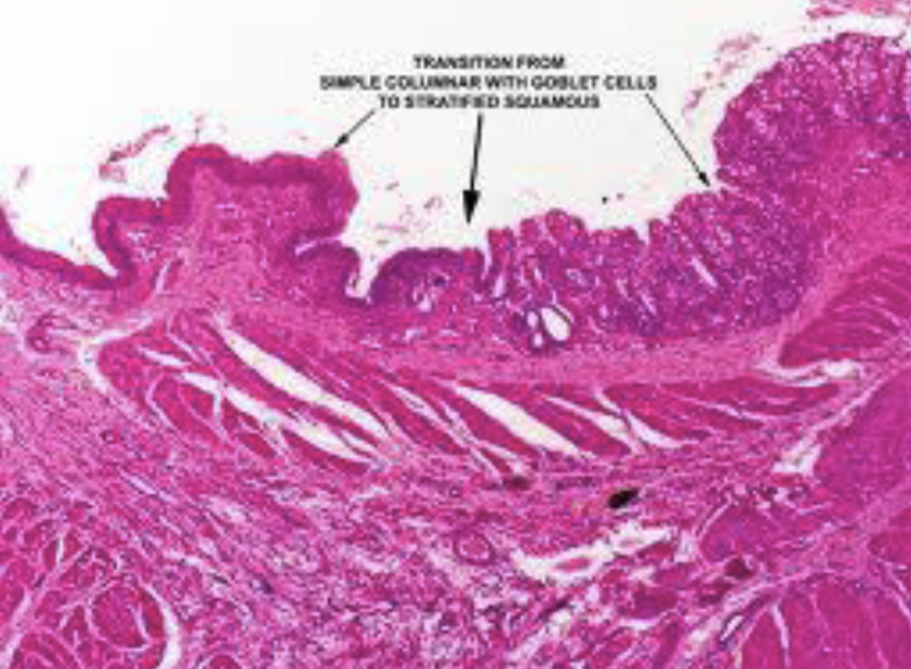 <p>anus simple, rectum stratified</p>