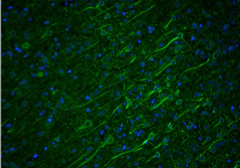 <p>stains <strong>axons </strong>fluorescently to a color of your choice. Double-stain with specific myelin markers</p>
