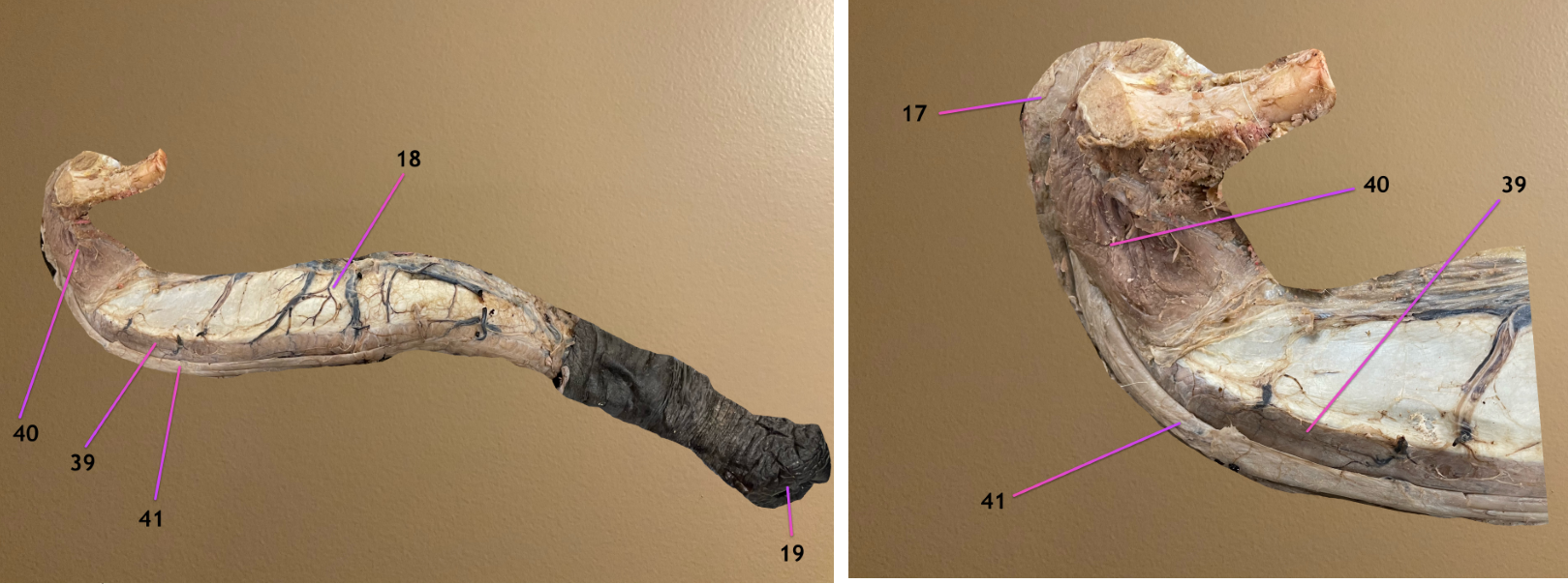 <p>pic 1: lateral view of penis</p><p>pic 2: same but zoomed in on root of penis</p><p>.</p><p>label 17-19</p>