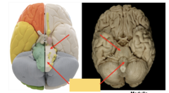 <p>What part of the brain stem is this pointing to? (INFERIOR)</p>