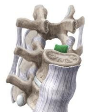 <p><span>Ligamentum longitduniale posterius</span></p>
