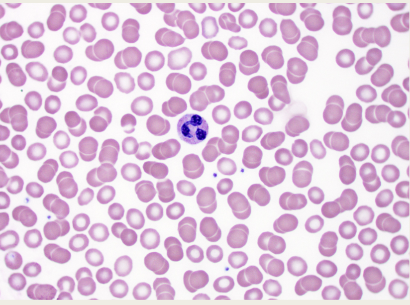 <p>What is this image of?</p>