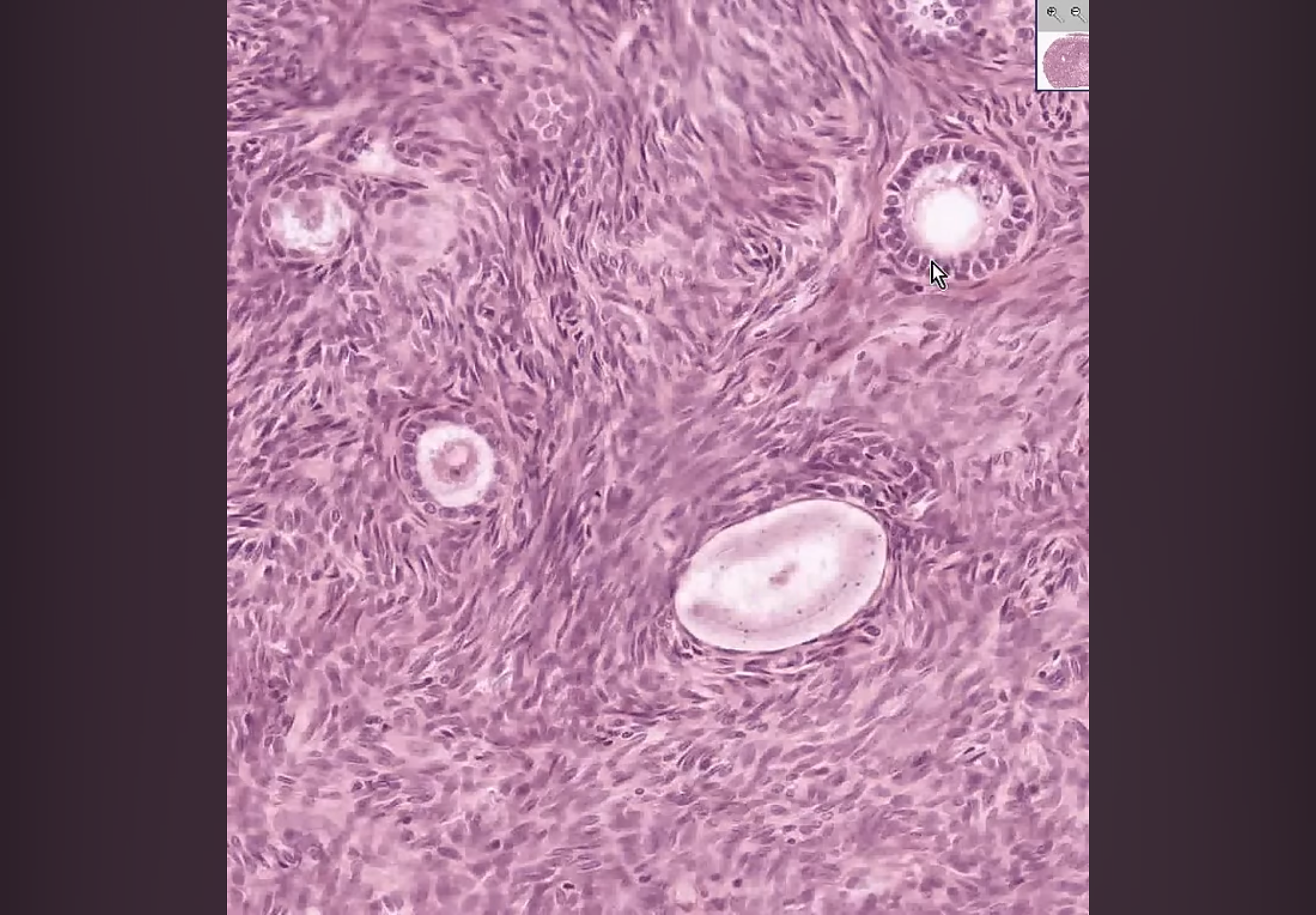 <p>What kind of follicle and why?</p>