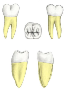 <p>Which tooth?</p>