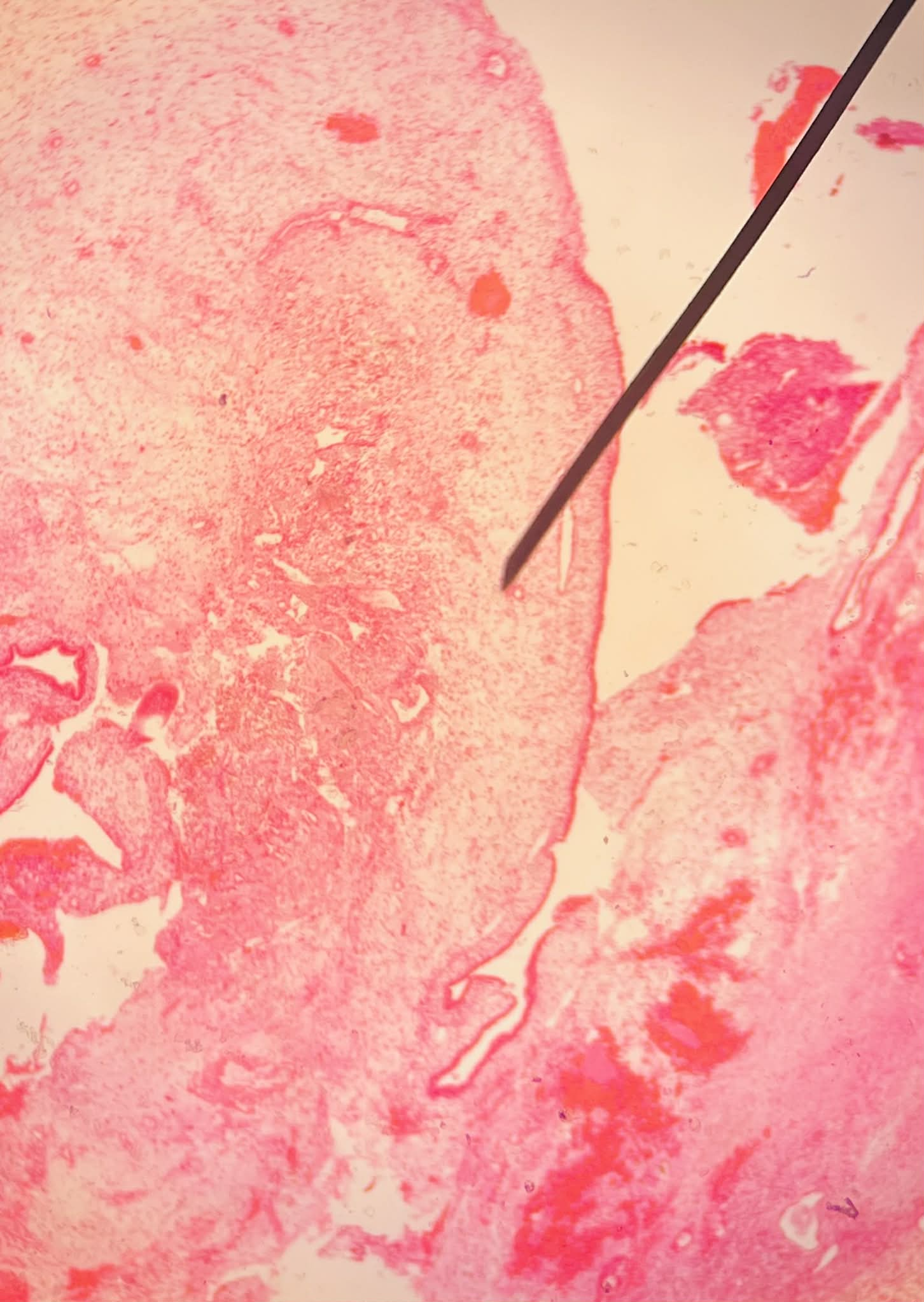 <p>Tiêu bản gì ?</p>