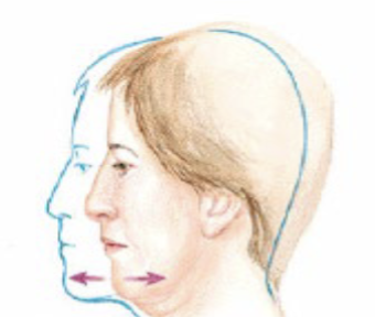<p>opposite movements of the shoulder blades (scapulae). (1) moves the shoulder blades forward and away from the spine, causing the upper back to round. (2) pulls the shoulder blades backward and together toward the spine, opening up the chest.</p>