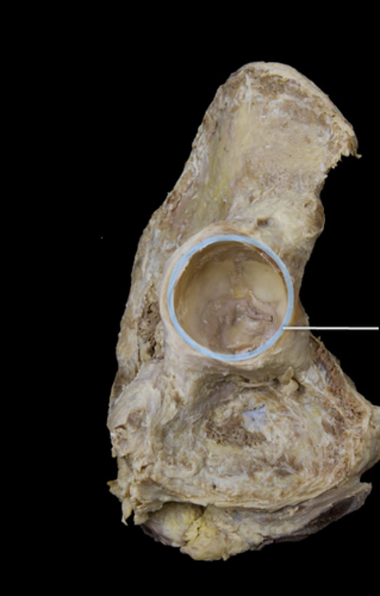 <p>lip of fibrocartilage that surrounds outer margin of the acetabulum on the hip bone</p>
