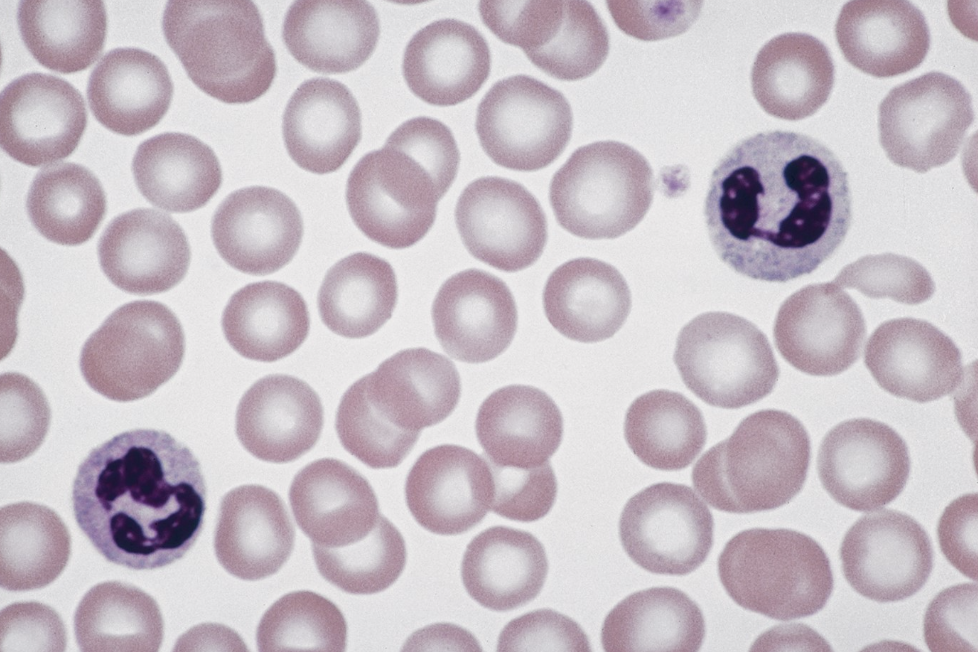 <p>ID white blood cells</p>