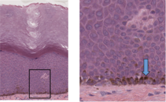 <p>What is the function of the brown granules in the cell at the arrow?</p>