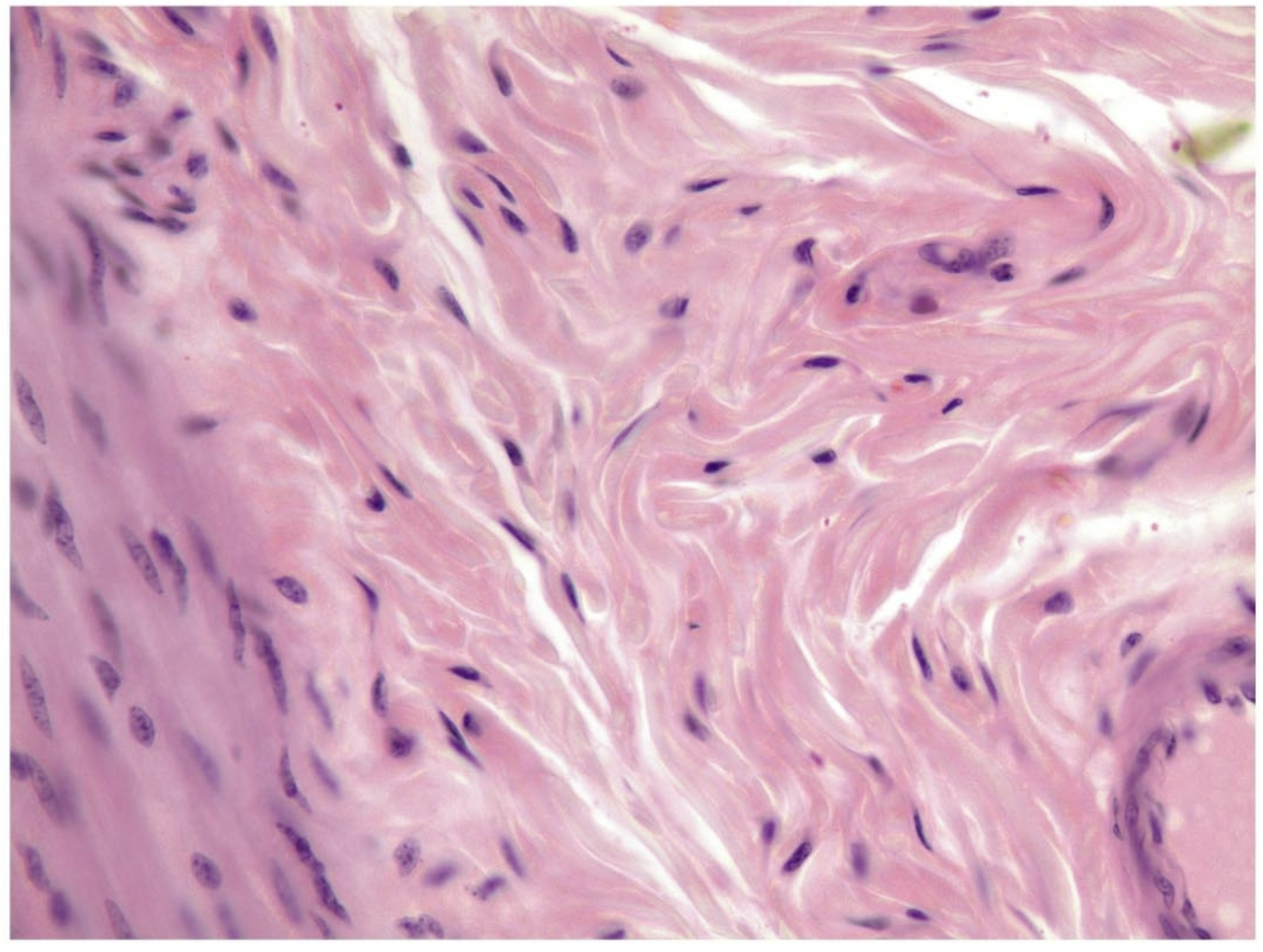 <p>what tissue is this</p>