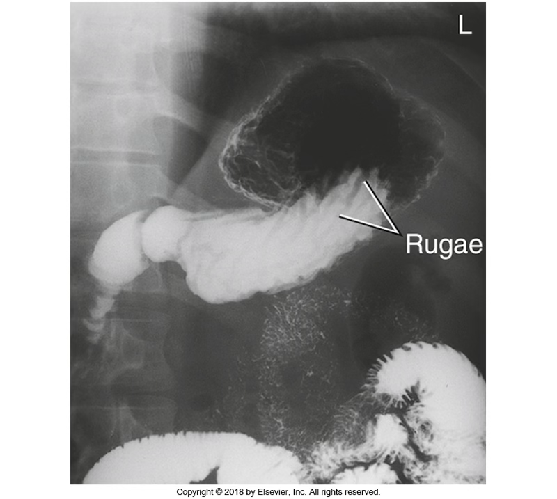 <p>What position was this patient in?</p>