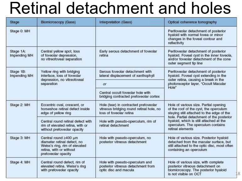 <ul><li><p><strong>Stage 0 (MH):</strong></p><ul><li><p>Perifoveolar posterior hyaloid detachment with normal fovea or minor contour changes</p></li></ul></li><li><p><strong>Stage 1A (Impending MH):</strong></p><ul><li><p>Central yellow spot, loss of foveolar depression, no vitreofoveal separation</p></li><li><p>Early serous foveolar detachment</p></li><li><p>OCT: perifoveolar hyaloid detachment + foveal cyst</p></li></ul></li><li><p><strong>Stage 1B (Impending MH):</strong></p><ul><li><p>Yellow ring with bridging interface, loss of foveolar depression</p></li><li><p>Serous detachment or occult hole with bridging prefoveolar cortex</p></li><li><p>OCT: cyst extends into outer retina (“occult macular hole”)</p></li></ul></li><li><p><strong>Stage 2 (Full-thickness MH):</strong></p><ul><li><p>Small eccentric/oval or crescent defect within yellow ring</p></li><li><p>Vitreous still attached (no full PVD)</p></li><li><p>May have pseudo-operculum</p></li></ul></li><li><p><strong>Stage 3 (MH):</strong></p><ul><li><p>Central round defect ≥400 µm with elevated rim</p></li><li><p>No Weiss ring (no complete PVD)</p></li><li><p>Partial vitreous detachment</p></li></ul></li><li><p><strong>Stage 4 (MH):</strong></p><ul><li><p>Full-thickness hole with complete posterior vitreous detachment</p></li><li><p>Weiss ring present</p></li><li><p>Posterior hyaloid no longer visible on OCT</p></li></ul></li><li><p><strong>Key concepts:</strong></p><ul><li><p>Progression from foveal cyst → full-thickness hole</p></li><li><p>Increasing vitreous separation and traction changes across stages</p></li></ul></li></ul><p></p>