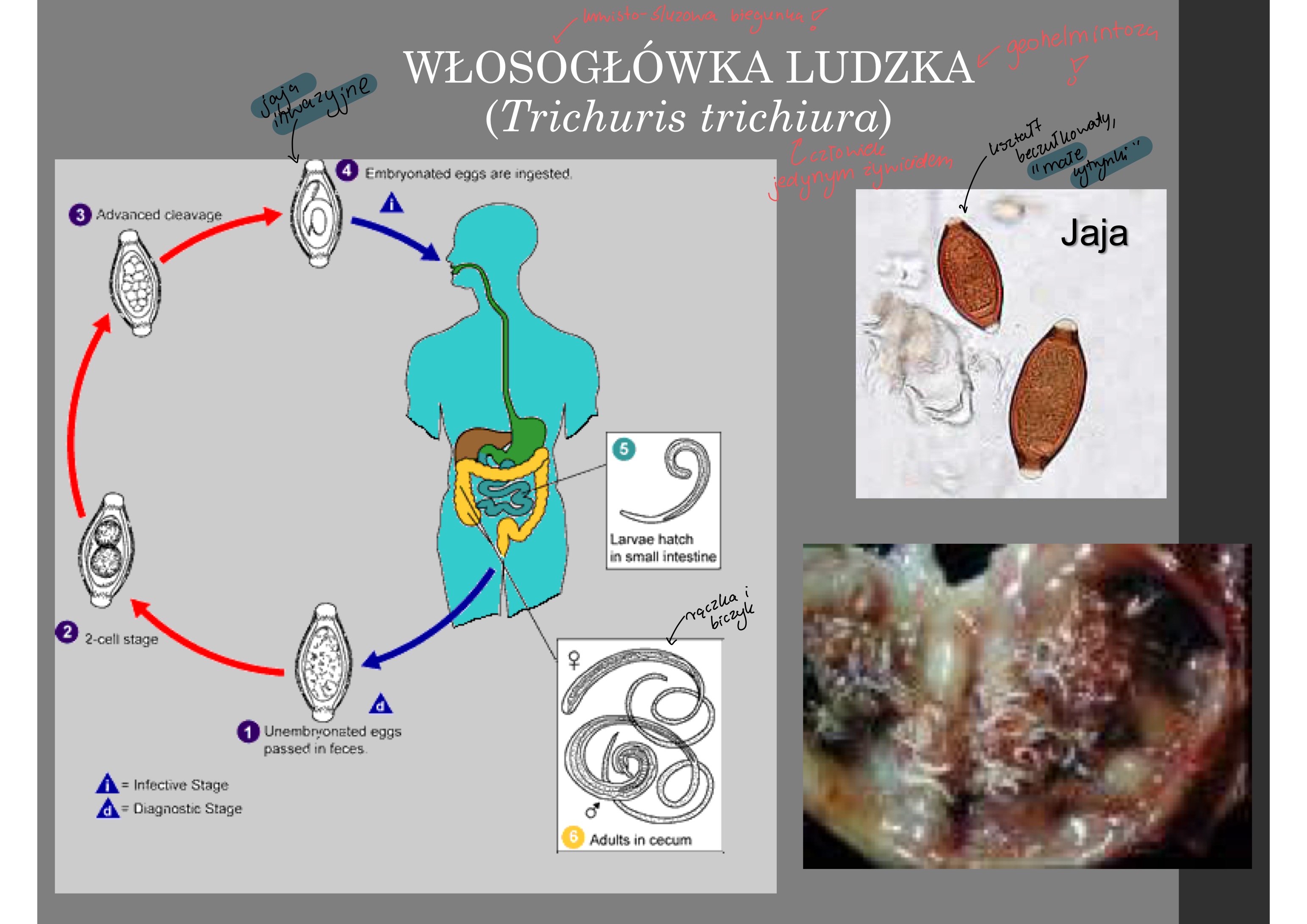 <p>w jelicie grubym</p><p>(to odróżnia ją od glisty ludzkiej która w cienkim)</p>