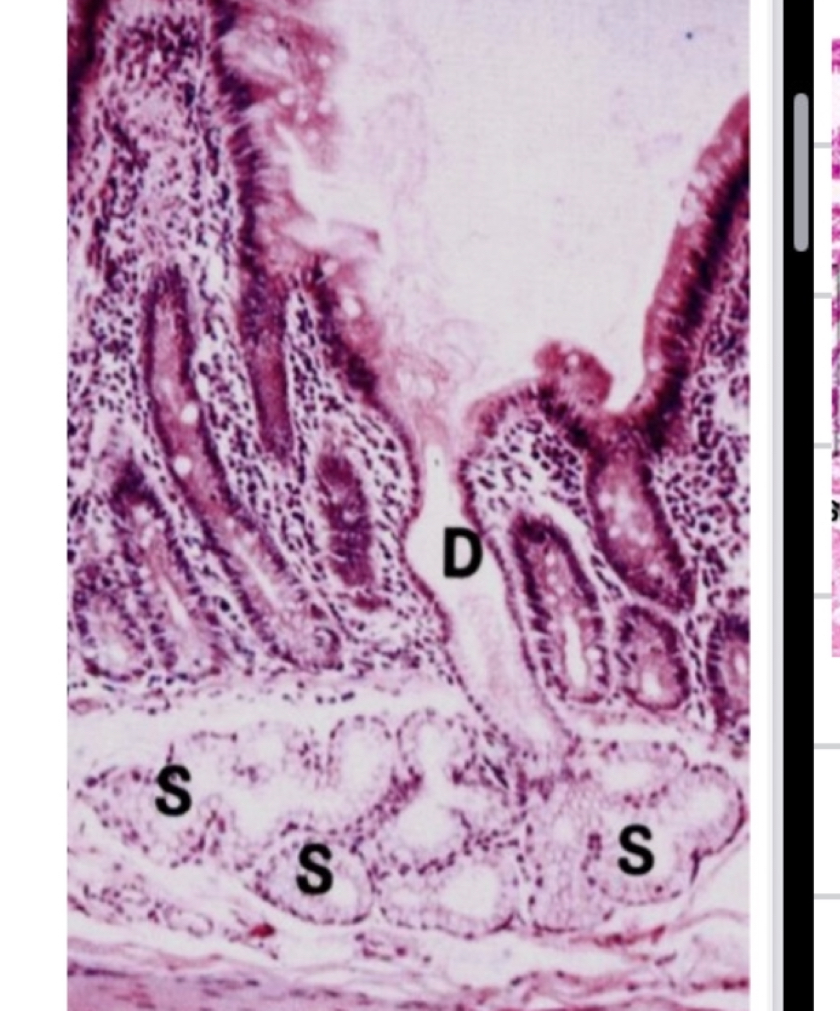 <p>compound and tubular and it is in the duodenum mucosa </p><p>As it is mucous it is a merocrine secretion pale, looking cells </p><p>Easy to recognize: VILLI</p><p>Duodenum submucosa is rich in alkaline secretion </p><p>Protecting the doudenum from the acids of the stomach </p><p>It serves to 1. Lubrificate the intestinal wall 2. To allow to ave the correct alkaline enviroment to be active for absorption </p>