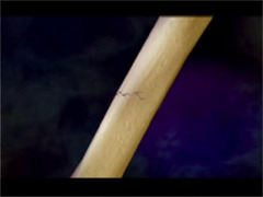 <p>- fine crack in which sections of bone remain aligned</p>