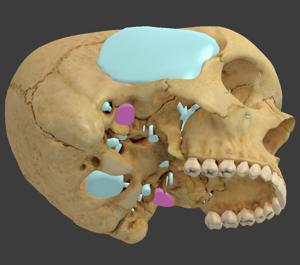 <p>bone/structure highlighted in pink</p>