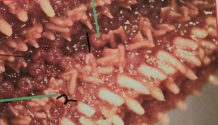 <p>point 1 on this sea star</p>