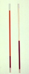 <p>What is happening in the left hematocrit tube?</p>