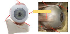 <p>extra ocular eye muscles: what is the highlighted part pointing to?</p>