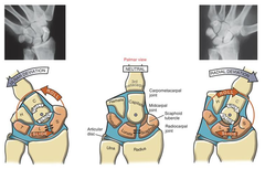 <p>Convex scaphoid and lunate roll radially and sliding ulnarly on concave radius</p>
