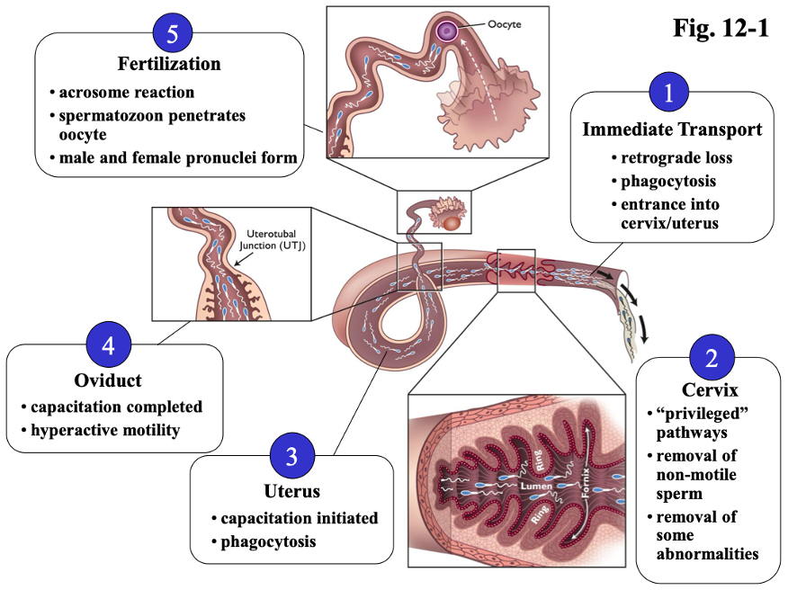 1. Immediate Transport; 2. Cervix; 3. Uterus; 4. Oviduct; 5. Fertilization.