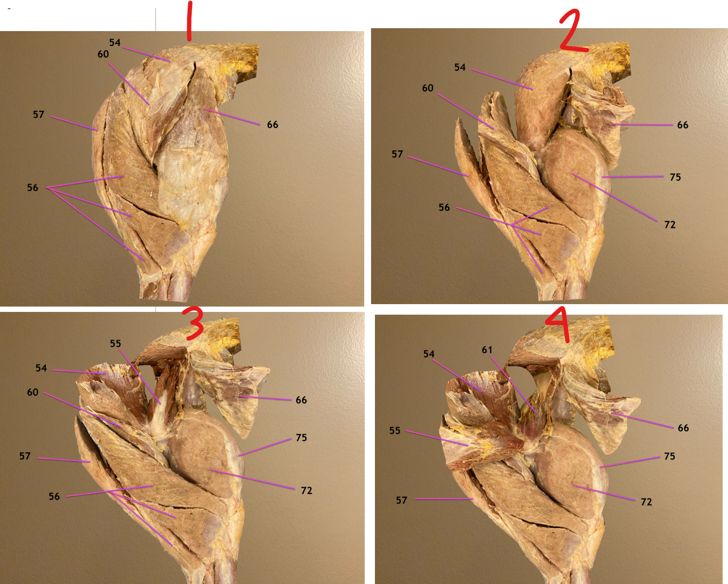 <p>all are lateral view of hip &amp; thigh, cranial to rt</p><p>pic 2: 57 &amp; 60 reflected caudally</p><p>pic 3: 54 reflected </p><p>pic 4: 55 &amp; 56 reflected</p><p>.</p><p>label 54-57</p>