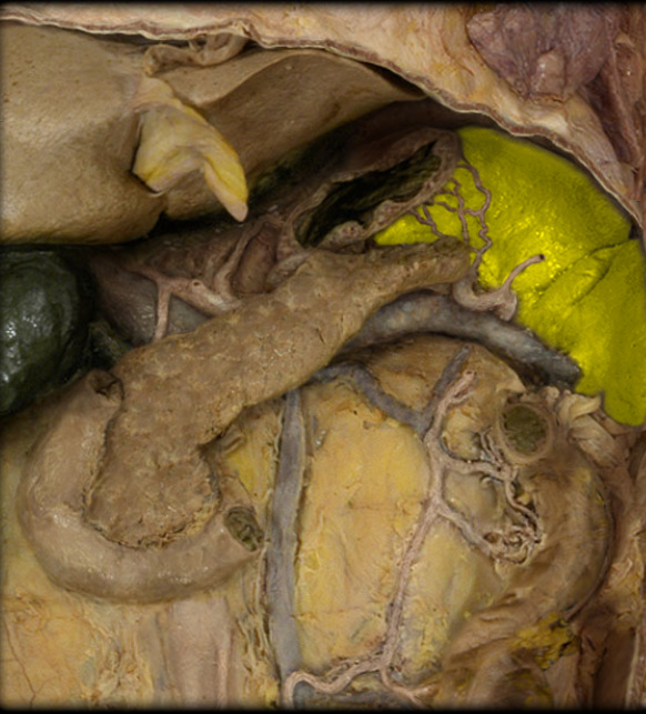 <p>make sure to not confuse with kidney, it’ll be on the left side of the body more to the side of kidney typically</p>