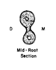 <p>- similar to type I with deep depressions</p><p>- thin lamination connects the buccal and lingual</p>