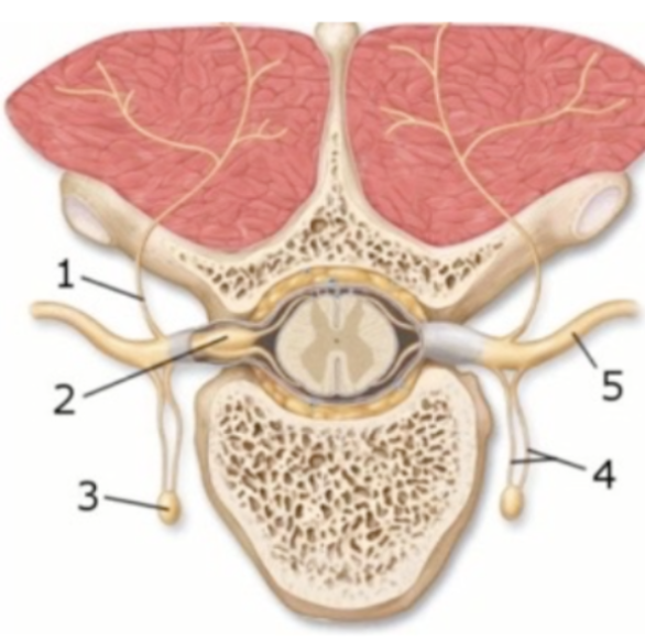 <p><span style="background-color: transparent; font-family: "Times New Roman", serif;"><strong>This figure demonstrates the branches of the spinal nerve. What structure(s) does number 5 indicate?</strong></span></p><p><span style="background-color: transparent; font-family: "Times New Roman", serif;">Dorsal ramus </span></p><p><span style="background-color: transparent; font-family: "Times New Roman", serif;">Dorsal root ganglion </span></p><p><span style="background-color: transparent; font-family: "Times New Roman", serif;">Rami communicans </span></p><p><span style="background-color: transparent; font-family: "Times New Roman", serif;">Sympathetic trunk ganglion </span></p><p><span style="background-color: transparent; font-family: "Times New Roman", serif;">Ventral ramus</span></p>