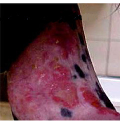 <p>What is this penis abnormality?</p>