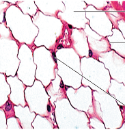 <p>what tissue</p>