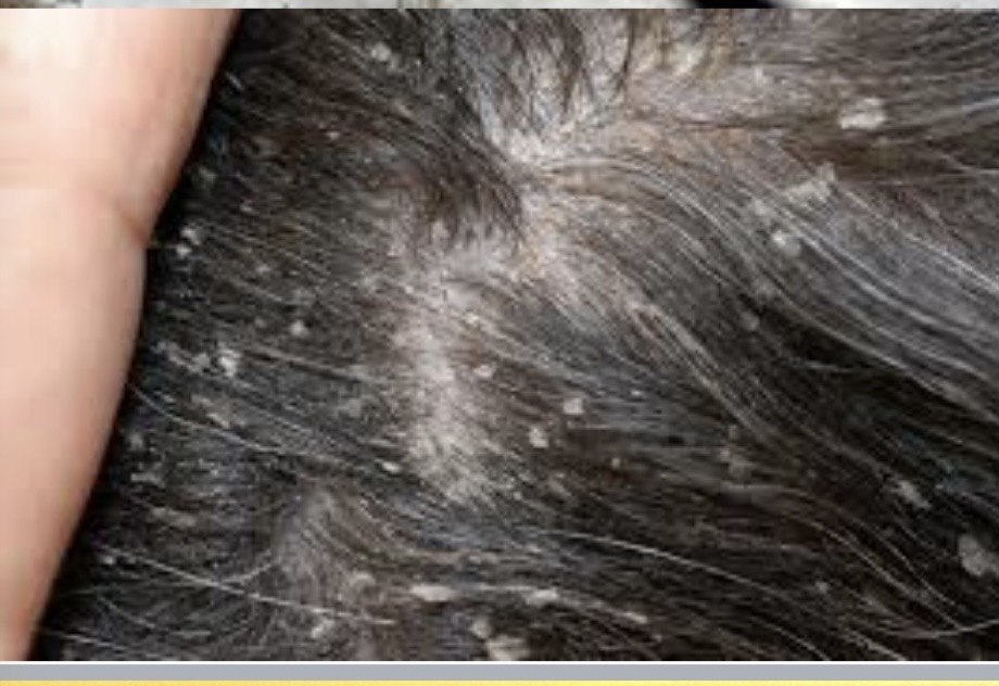 <img src="blob:null/cdc12e6a-0f2f-4388-a5c1-3fe7fe253fde" width="290" height="174"><p>Moving</p>