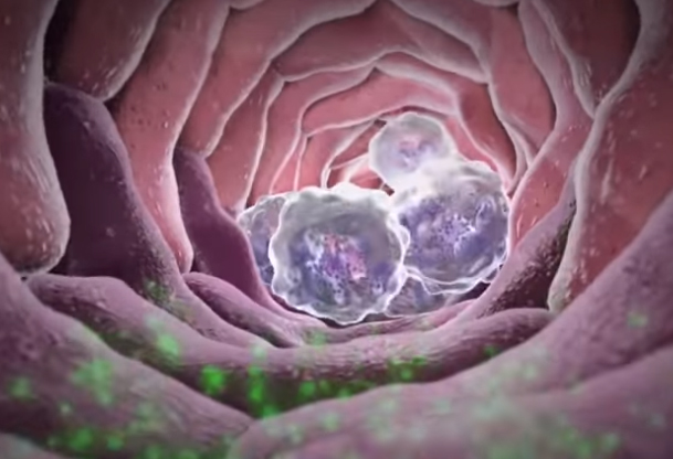 <p><span>How do these cells move from the blood into the infected tissue?</span></p>